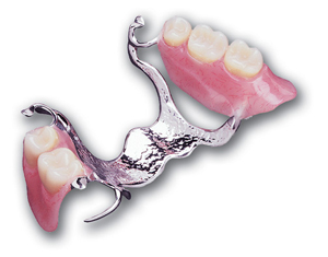 Alternative partial denture
